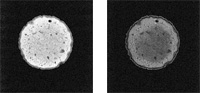 Rys. Obrazy MRI przekroju przez ser dla protokołu PDW (a) i T2W (b)